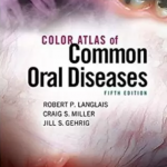 Color Atlas of Common Oral Diseases 5th Edition PDF Free Download
