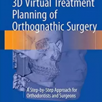 3D Virtual Treatment Planning of Orthognathic Surgery 1st Edition PDF Free Download