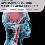 Atlas of Operative Oral and Maxillofacial Surgery PDF Free Download