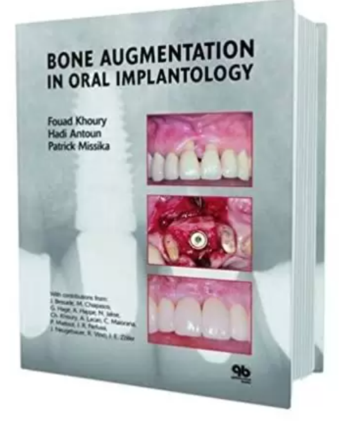 Bone Augmentation in Oral Implantology by Fouad Khoury PDF Free Download