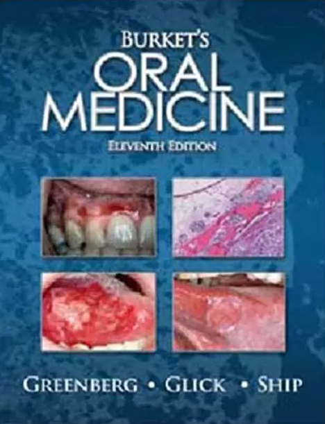 Burket’s Oral Medicine 11th Edition PDF Free Download