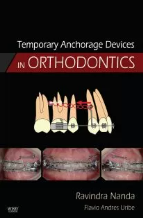 Download Anchorage Devices in Orthodontics PDF Free