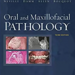 Oral and Maxillofacial Pathology Neville 3rd Edition PDF Free Download