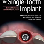 Download The Single-Tooth Implant: A Minimally Invasive Approach for Anterior and Posterior Extraction Sockets PDF Free