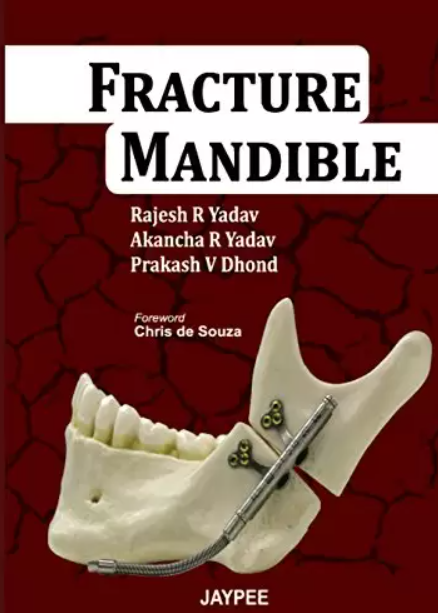 Fracture Mandible by Rajesh R Yadav PDF Free Download