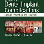 Dental Implant Complications 2nd Edition PDF Free Download