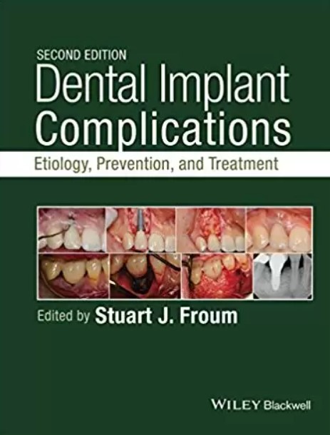 Dental Implant Complications 2nd Edition PDF Free Download