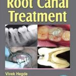 Step by Step Root Canal Treatment PDF Free Download