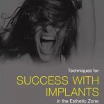 Techniques for Succcess with Implants in Esthetic Zone PDF Free Download