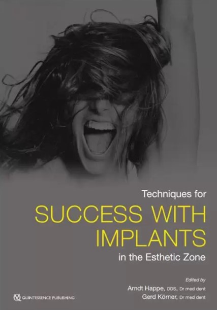 Techniques for Succcess with Implants in Esthetic Zone PDF Free Download