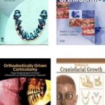 Orthodontics Books (Complete 2021) PDF Free Download