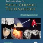 Introduction to Metal-Ceramic Technology 2nd Edition PDF Free Download