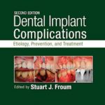 Dental Implant Complications 2nd Edition Etiology, Prevention, and Treatment PDF Free Download