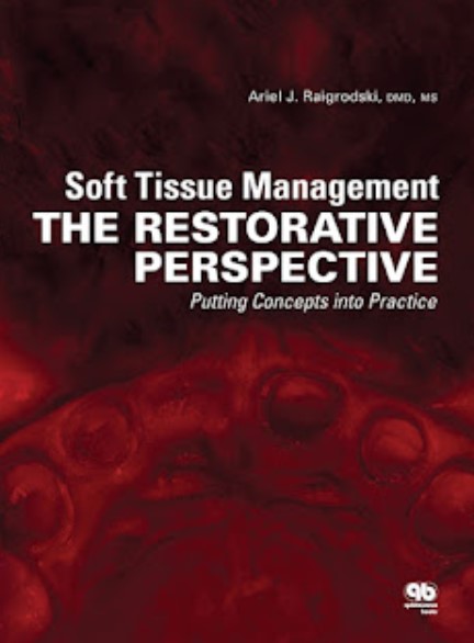 Download Soft Tissue Management The Restorative Perspective Putting Concepts into Practice PDF Free 