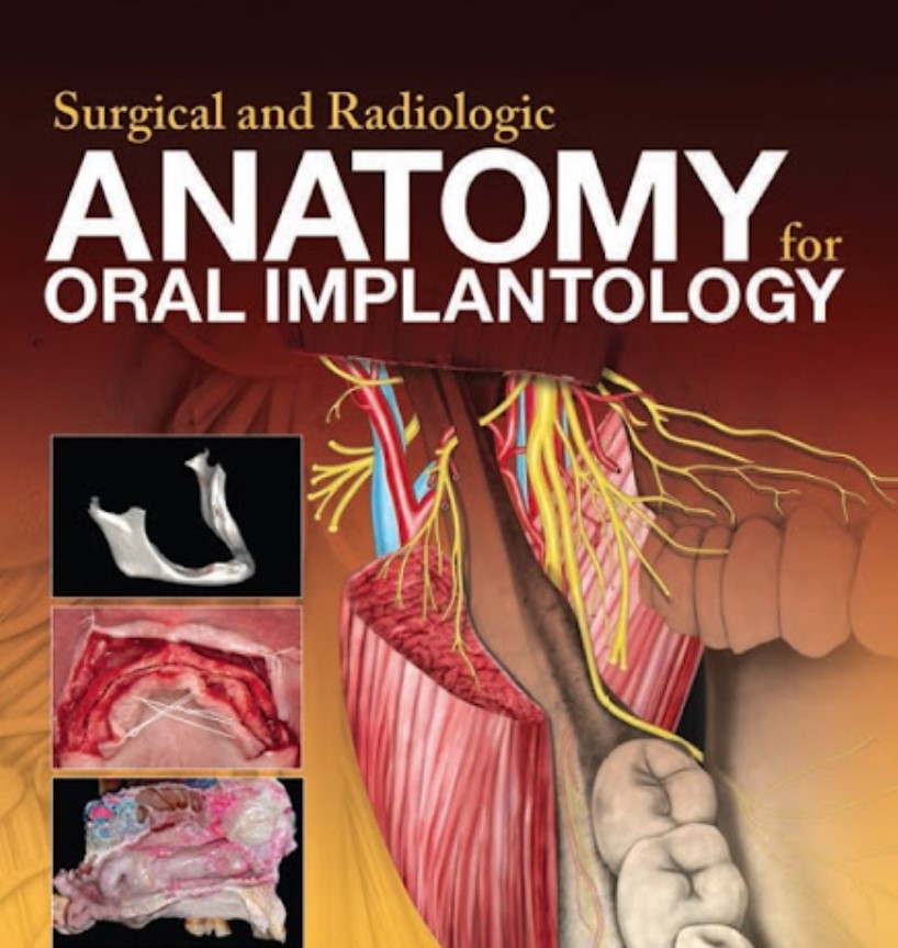 Surgical and Radiologic Anatomy of Oral Implantology PDF Free Download