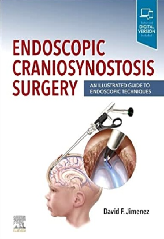 Endoscopic Craniosynostosis Surgery: An Illustrated Guide to Endoscopic Techniques 1st Edition PDF 