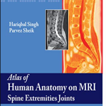Atlas Of Human Anatomy On MRI Spine Extremities Joints 1st Edition PDF Free Download