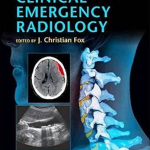 Clinical Emergency Radiology 2nd Edition PDF Free Download