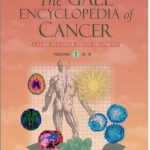 The Gale Encyclopedia Of Cancer : A Guide To Cancer And Its Treatments 2nd Edition PDF