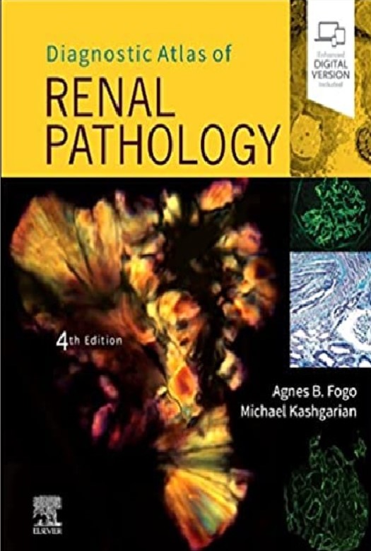 Diagnostic Atlas of Renal Pathology 4th Edition PDF Free