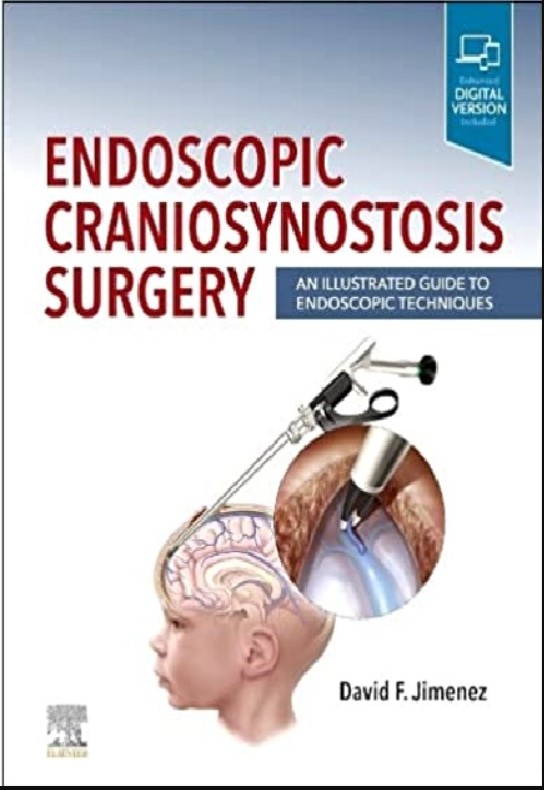 Endoscopic Craniosynostosis Surgery: An Illustrated Guide to Endoscopic Techniques 1st Edition PDF Free 