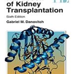Handbook of Kidney Transplantation 6th Edition PDF Free