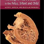 Pathology of Heart Disease in the Fetus, Infant and Child: Autopsy, Surgical and Molecular Pathology PDF