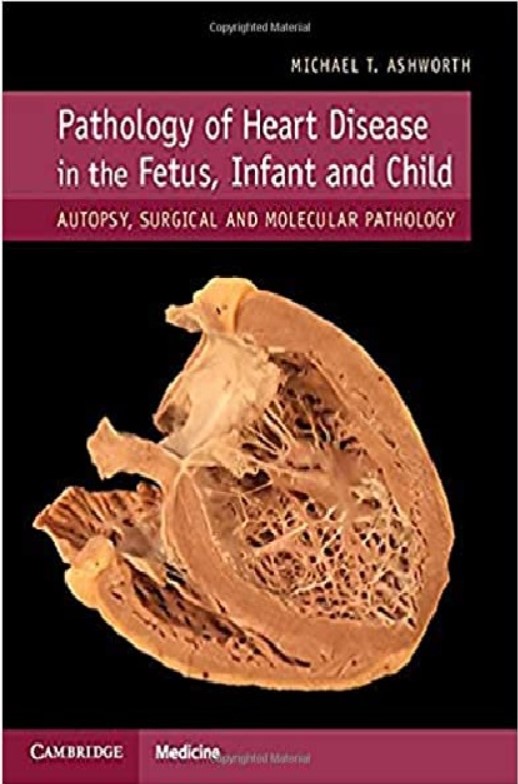 Pathology of Heart Disease in the Fetus, Infant and Child: Autopsy, Surgical and Molecular Pathology PDF