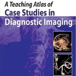 A Teaching Atlas of Case Studies in Diagnostic Imaging 1st Edition PDF Free