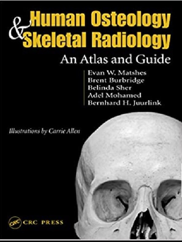 Human Osteology and Skeletal Radiology: An Atlas and Guide 1st Edition PDF Free
