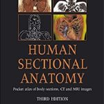 Human Sectional Anatomy: Atlas of Body Sections, CT and MRI Images 3rd Edition PDF Free