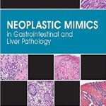 Neoplastic Mimics in Gastrointestinal and Liver Pathology 1st Edition PDF Free