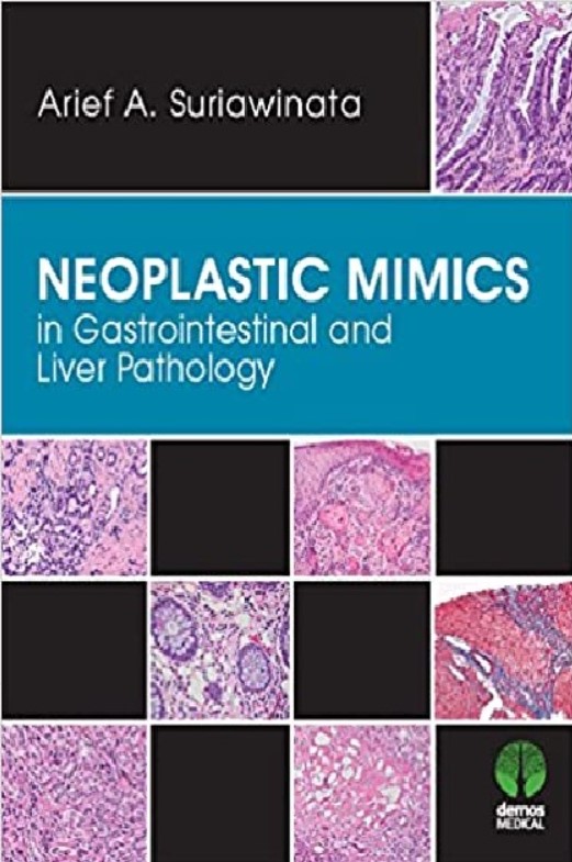 Neoplastic Mimics in Gastrointestinal and Liver Pathology 1st Edition PDF Free