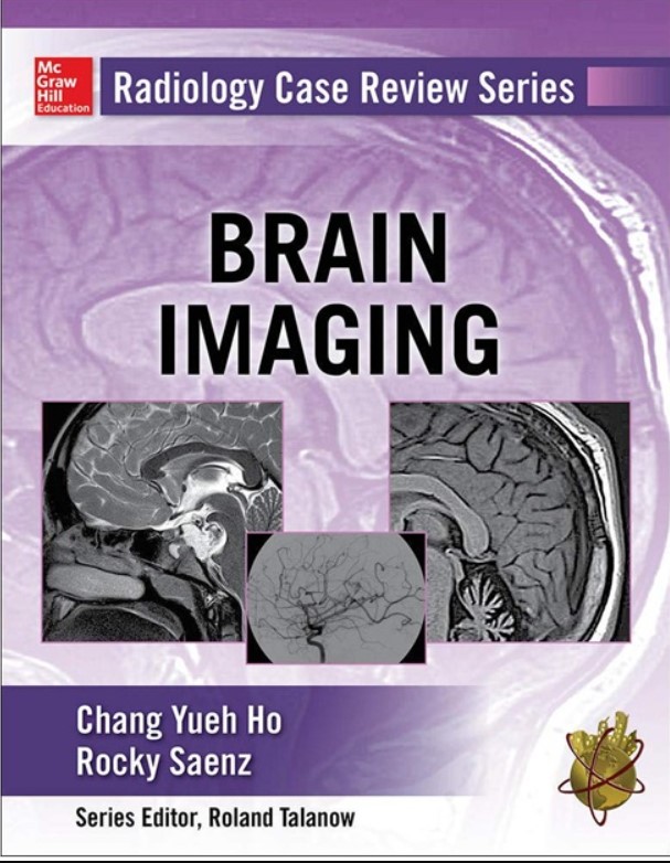 Radiology Case Review Series: Brain Imaging PDF Free