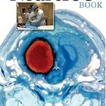 The NeuroICU Book 2nd Edition PDF Free