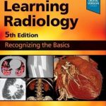 Learning Radiology: Recognizing the Basics 5th Edition PDF Free