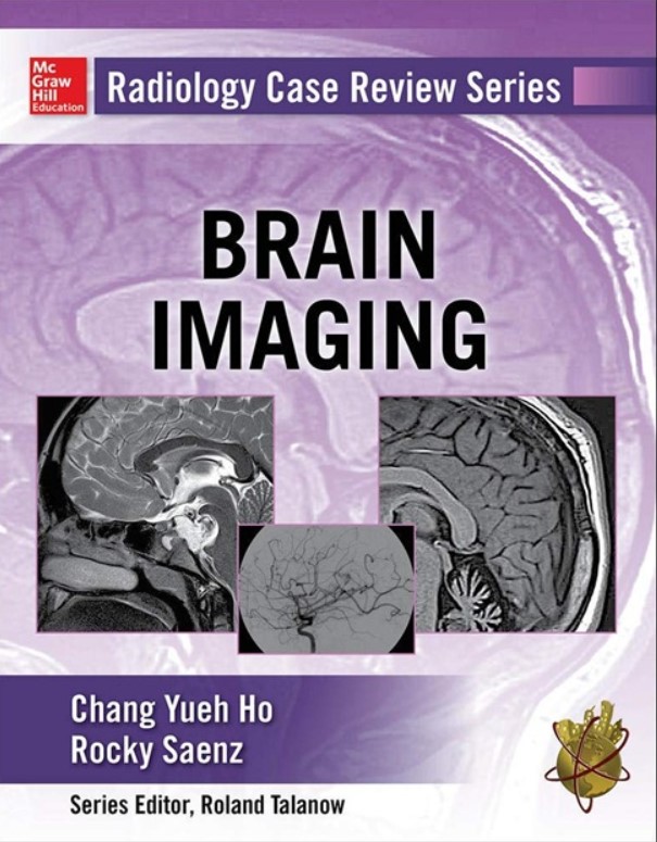 Radiology Case Review Series: Brain Imaging PDF Free