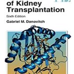 andbook of Kidney Transplantation 6th Edition PDF Free