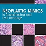 Neoplastic Mimics in Gastrointestinal and Liver Pathology 1st Edition PDF Free Download