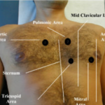 Clinical Examination Of Heart ( Precordium):